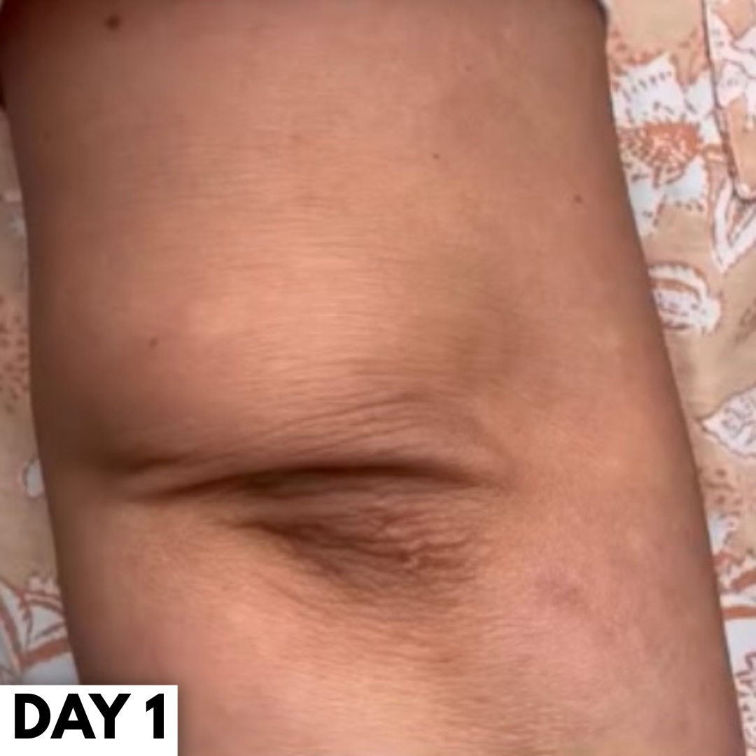 SkinVera™