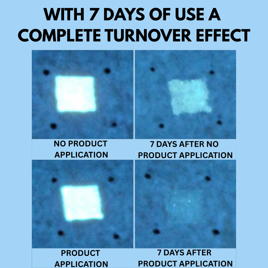 SkinVera™