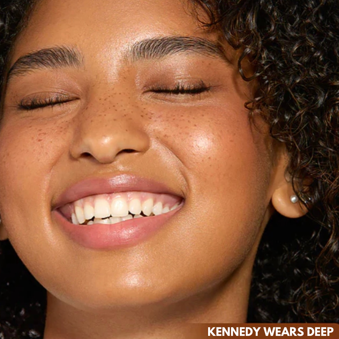 FreckleMuse™