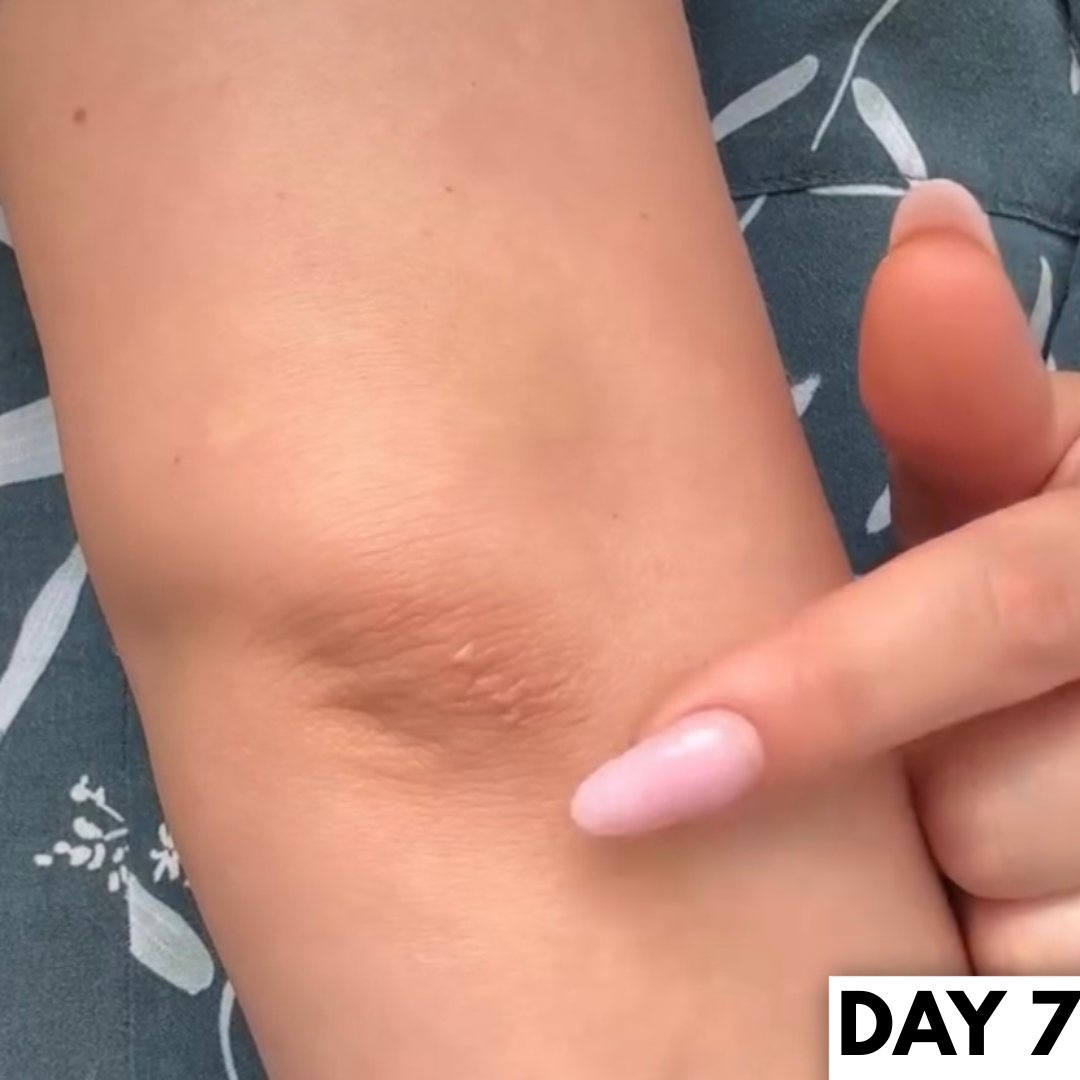 SkinVera™