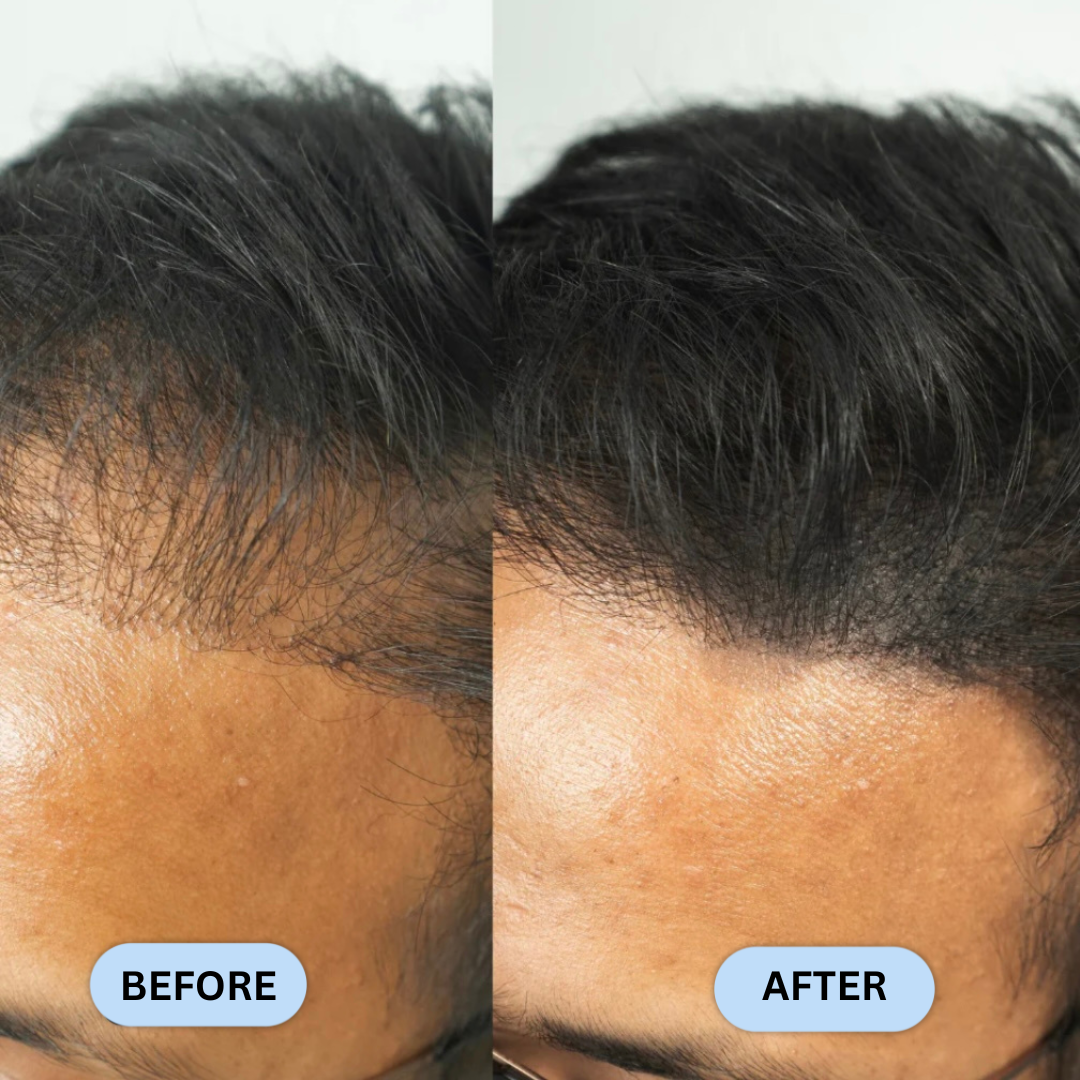 Hairline Filler Powder
