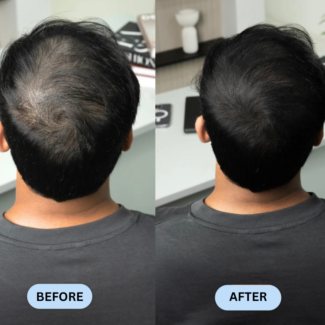 Hairline Filler Powder