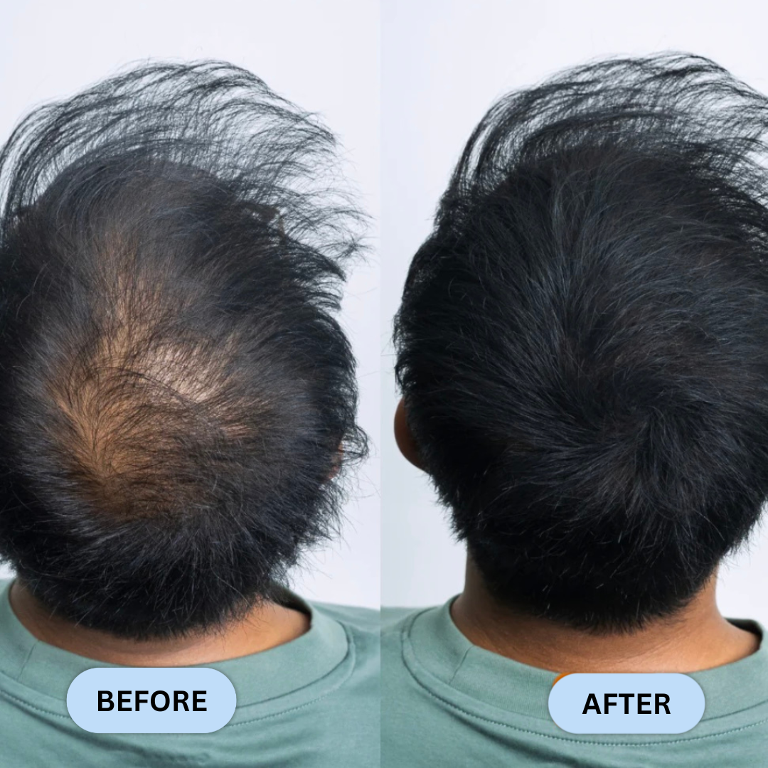 Hairline Filler Powder