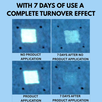 SkinVera™