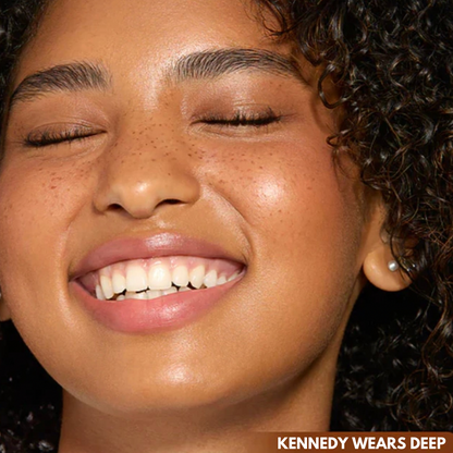 FreckleMuse™